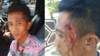 Sopir yang Dikeroyok Sekelompok Pemuda di Pamekasan Lapor ke Polisi