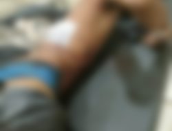 Terlibat Perang Sarung di Wanasari, Seorang Remaja Terluka Akibat Sabetan Sajam